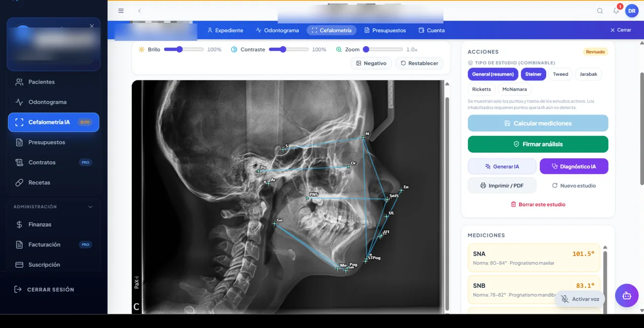 Cefalometría con IA en Odontix
